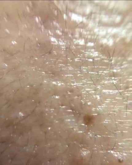 薬用保湿化粧水/オードムーゲ/化粧水を使ったクチコミ(10枚目)