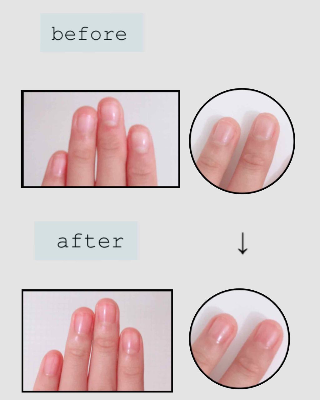 ネイルファンデーション/パラドゥ/マニキュアを使ったクチコミ(2枚目)