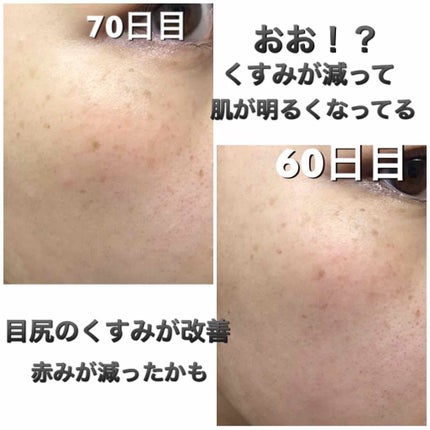 ブライトニングローション しっとり/DEW/化粧水を使ったクチコミ(2枚目)