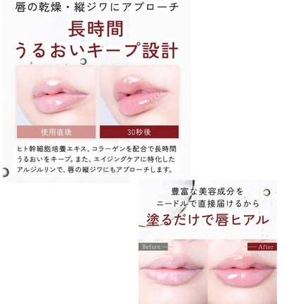 Q+Me ボムショットリッププランパー+/AGARISM/リッププランパーを使ったクチコミ(4枚目)