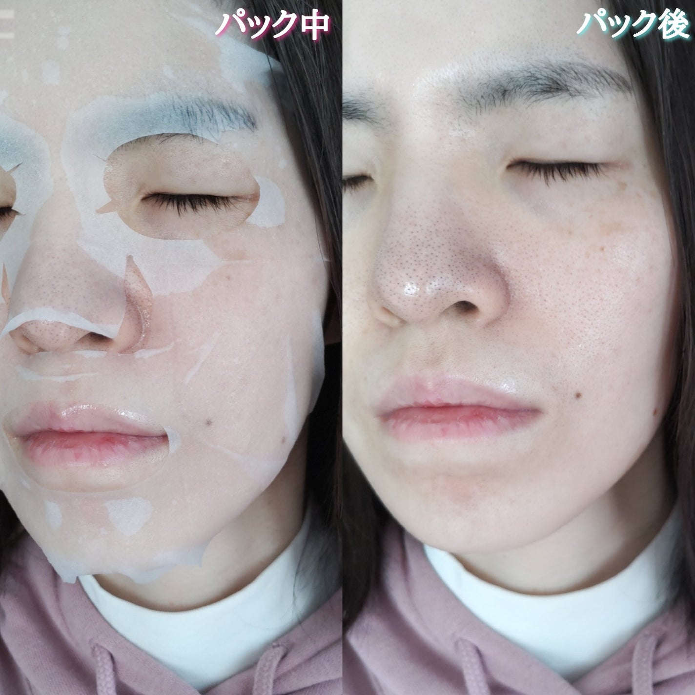 シートマスク VC100×CICA/CICIBELLA/シートマスク・パックを使ったクチコミ(6枚目)