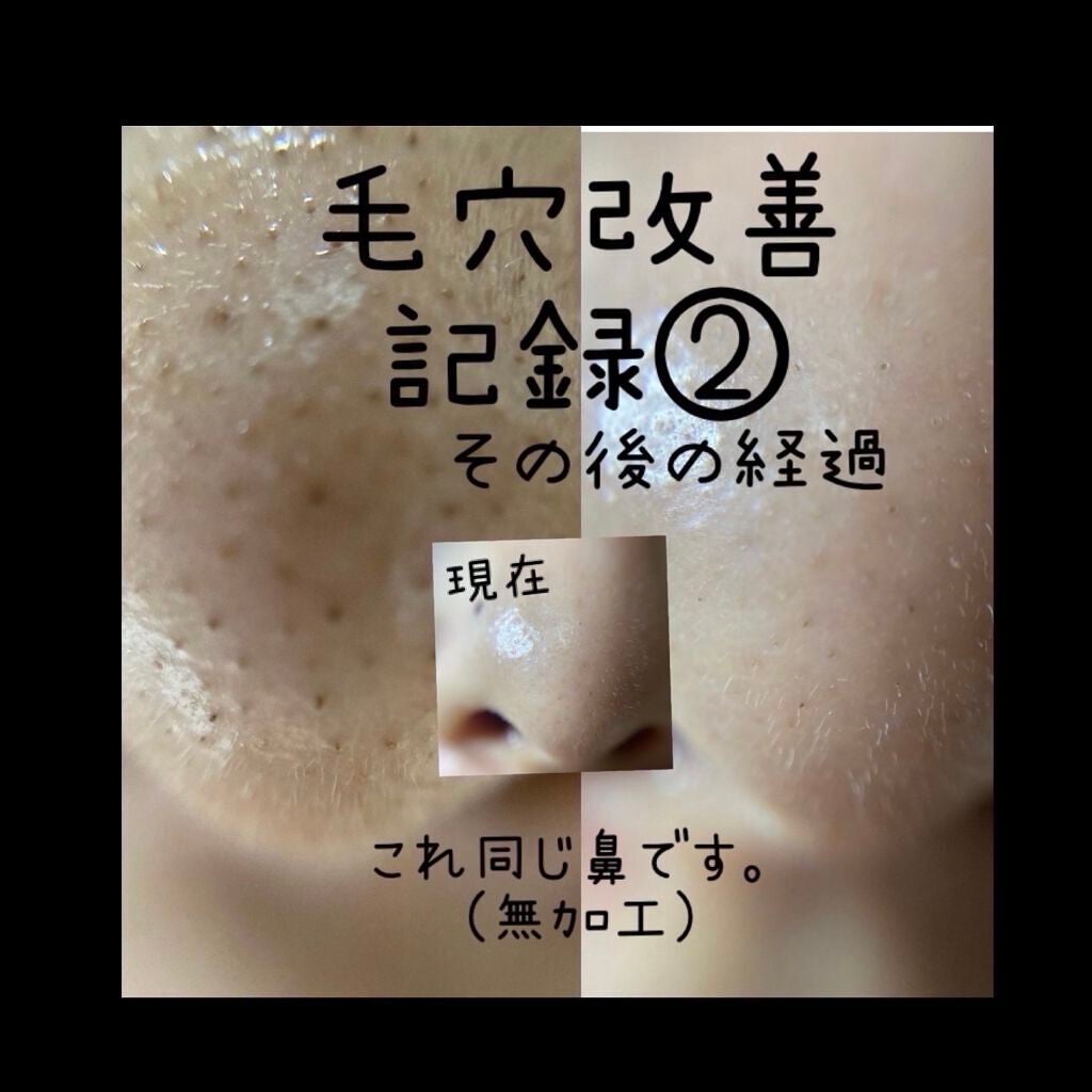 フレッシュリージュースドビタミンドロップ(35ml)/Klairs/美容液を使ったクチコミ(1枚目)