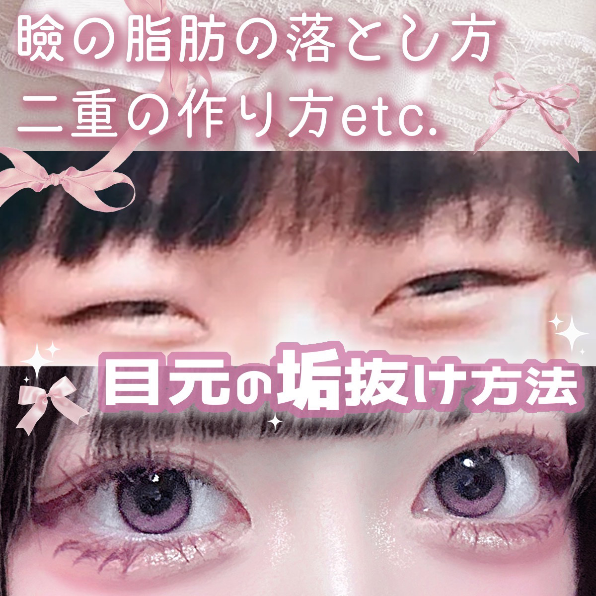 のびーるアイテープ（絆創膏タイプ、レギュラー）/DAISO/二重まぶた用アイテムを使ったクチコミ（1枚目）