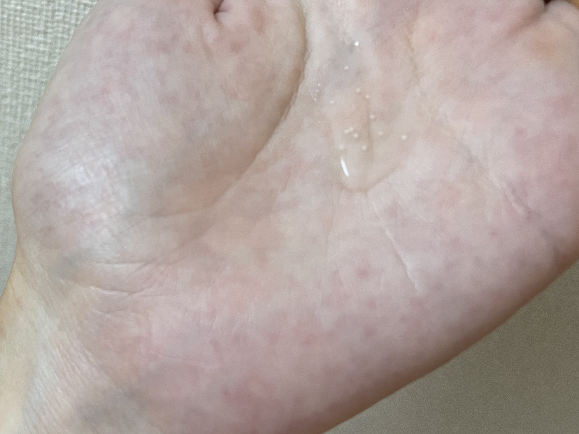 トーンブライトニング カプセルアンプル/SKIN1004/美容液を使ったクチコミ（2枚目）