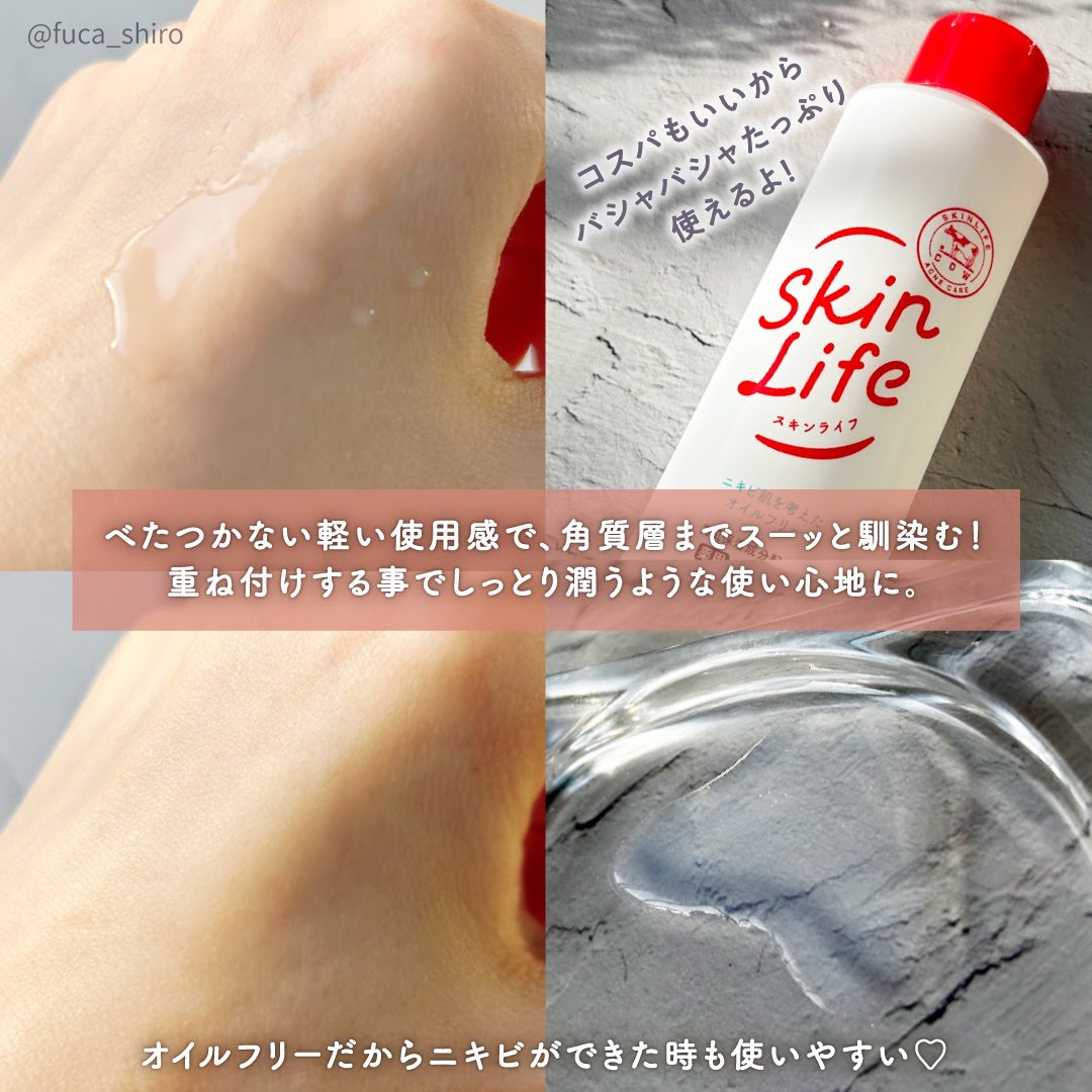 薬用化粧水/スキンライフ/化粧水を使ったクチコミ(4枚目)