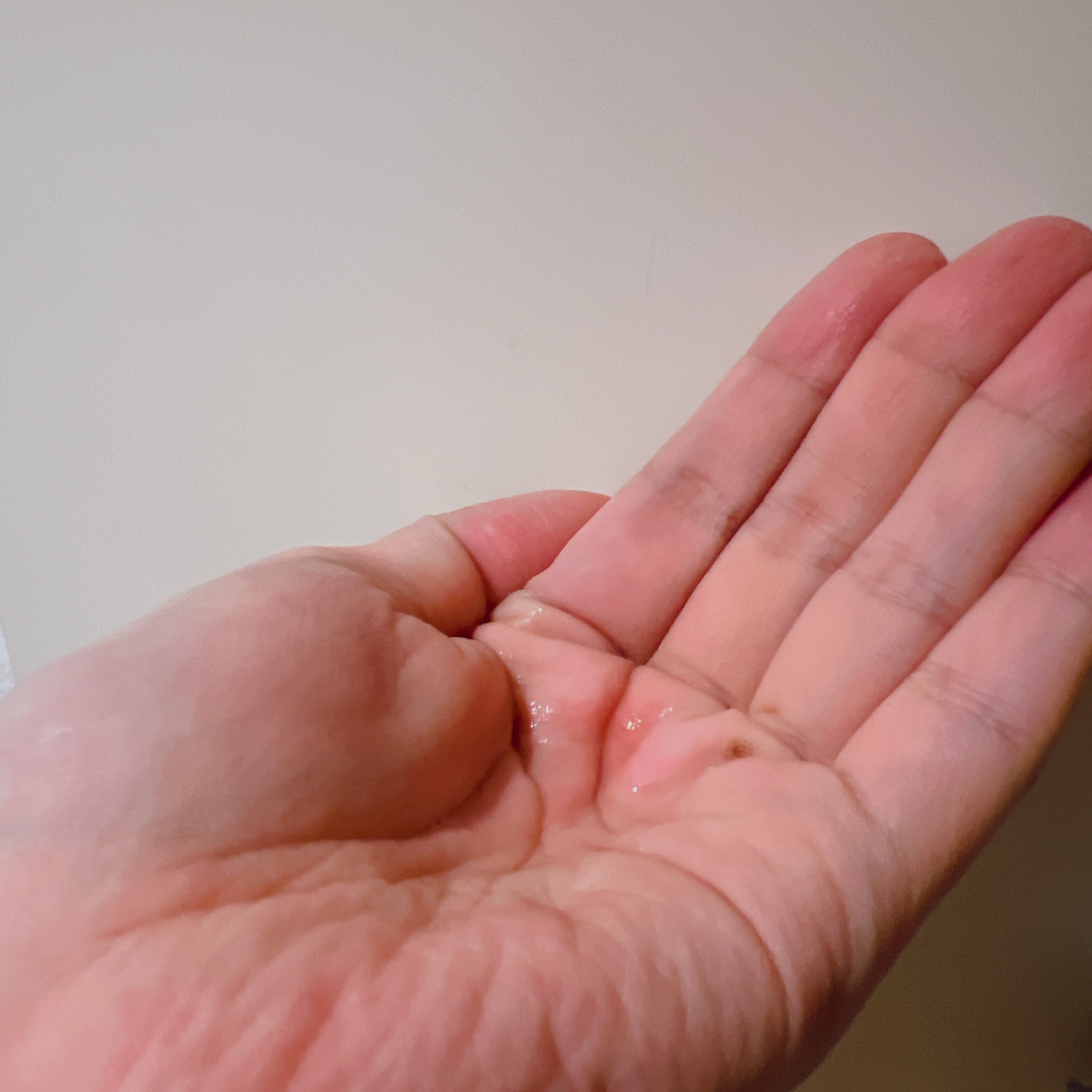 ピンクティーツリートナー/APLIN/化粧水を使ったクチコミ（3枚目）