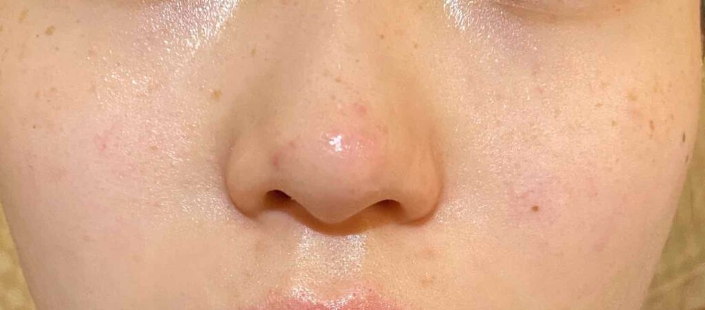 化粧水 敏感肌用 さっぱりタイプ/無印良品/化粧水を使ったクチコミ(4枚目)