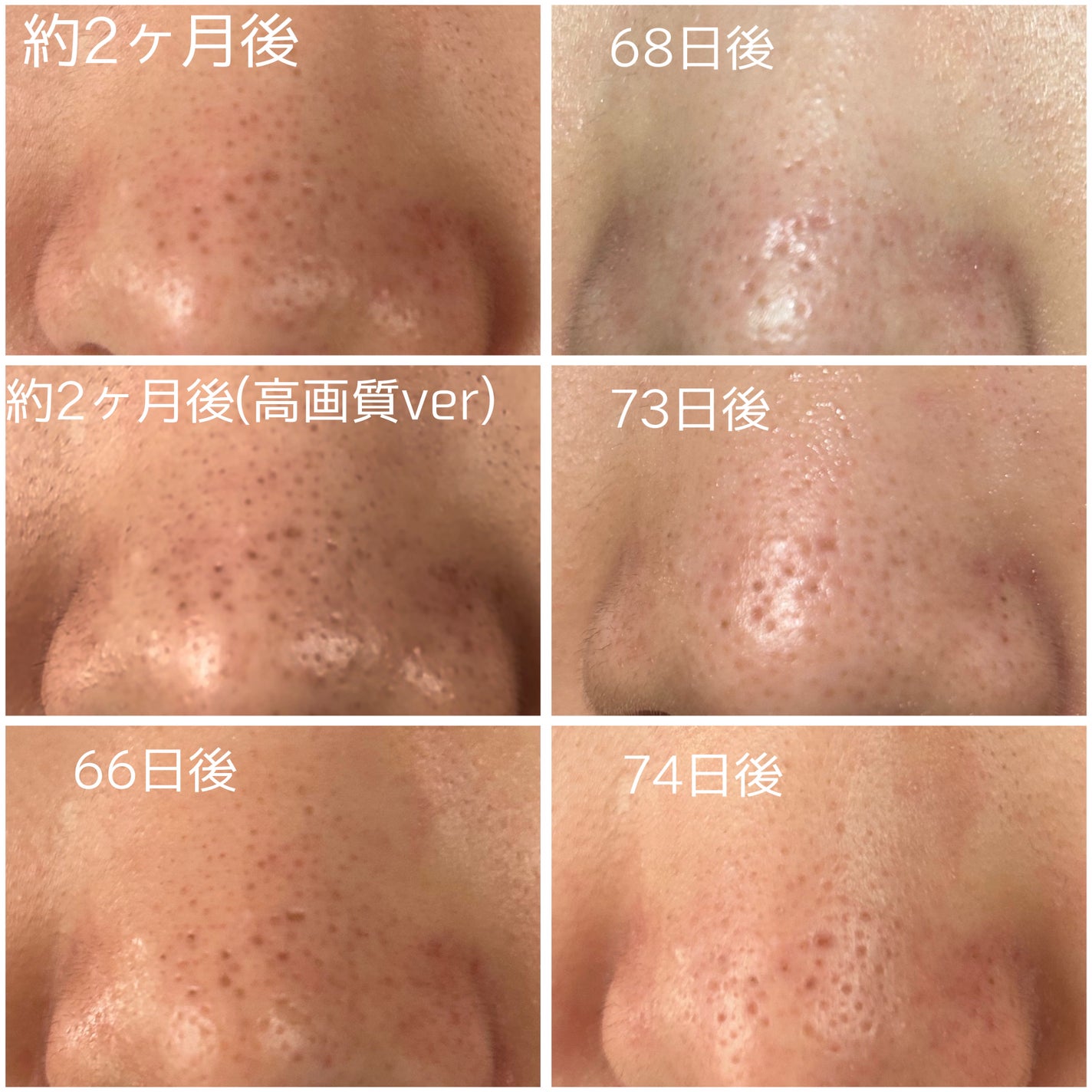 イチジク毛穴アンプル/Veganifect/美容液を使ったクチコミ(5枚目)