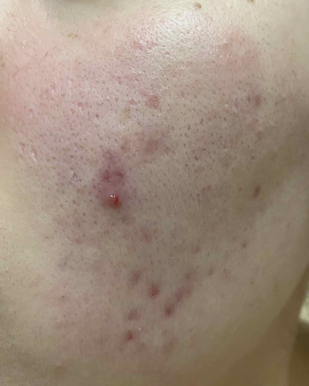 ハトムギ洗顔フォーム/株式会社イヴ/洗顔フォームを使ったクチコミ(3枚目)