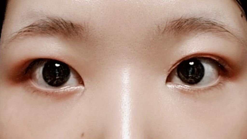 オリシキ アイリッドスキンフィルム /D-UP/二重まぶた用アイテムを使ったクチコミ(2枚目)