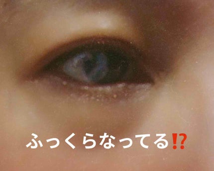 アイキララ/北の快適工房/アイケア・アイクリームを使ったクチコミ(3枚目)