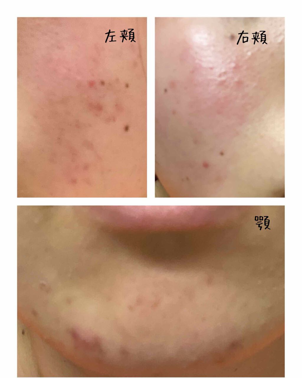 明色美顔水 薬用化粧水/美顔/化粧水を使ったクチコミ（2枚目）