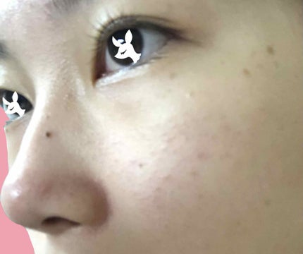 虚無虚無ぷりん on LIPS 「助けてください…肌が荒れまくってます…😭⚠️2枚目iPhone..」(2枚目)