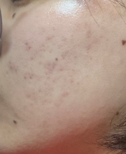 保湿クリーム /ちふれ/フェイスクリームを使ったクチコミ(2枚目)