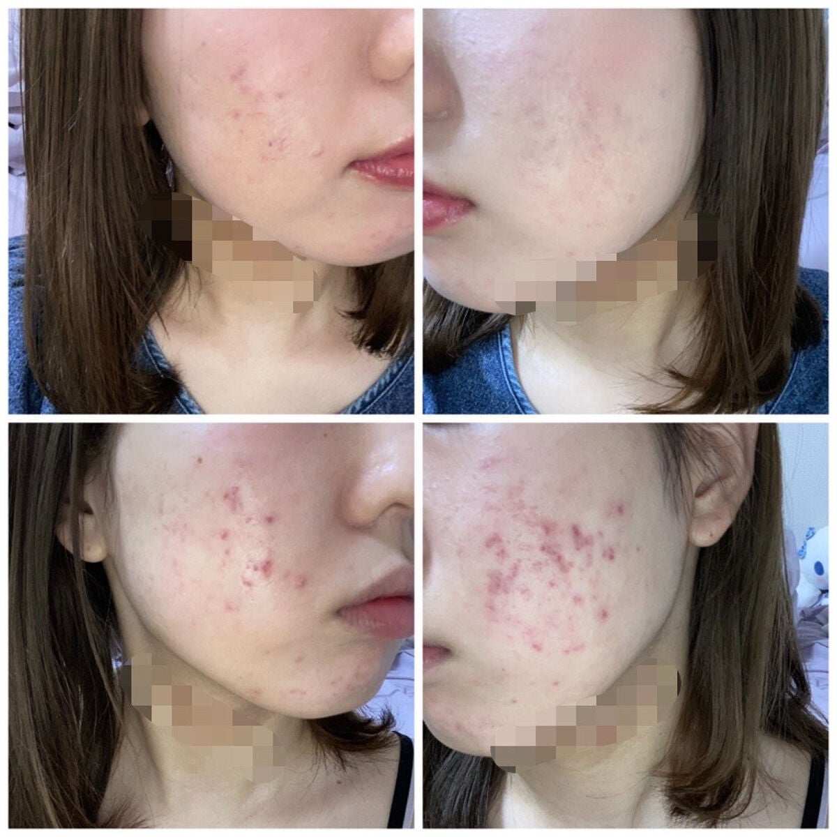 【旧】ディオールスキン フォーエヴァー スキン コレクト コンシーラー/Dior/リキッドコンシーラーを使ったクチコミ(1枚目)