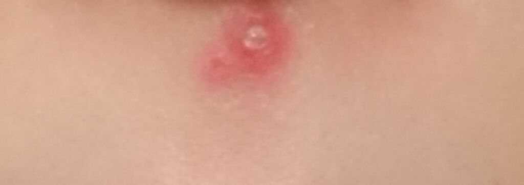 カプチュール ユース インテンス R オイル/Dior/美容液を使ったクチコミ（2枚目）