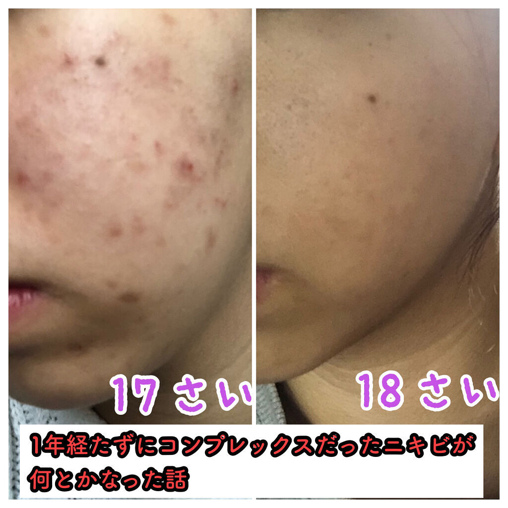 白潤 薬用美白化粧水/肌ラボ/化粧水を使ったクチコミ（1枚目）