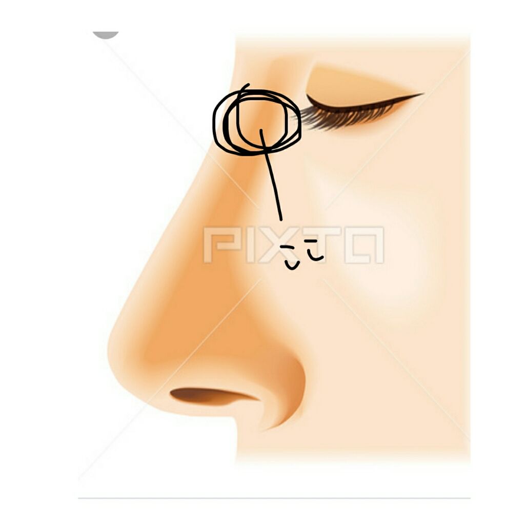 白潤 薬用美白化粧水/肌ラボ/化粧水を使ったクチコミ（2枚目）