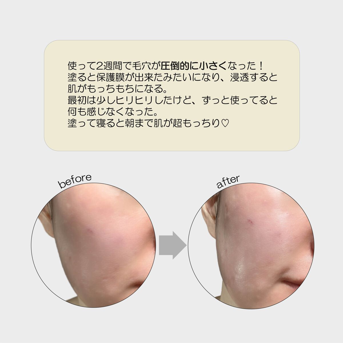 ザビタミンC23/IOPE/美容液を使ったクチコミ(3枚目)