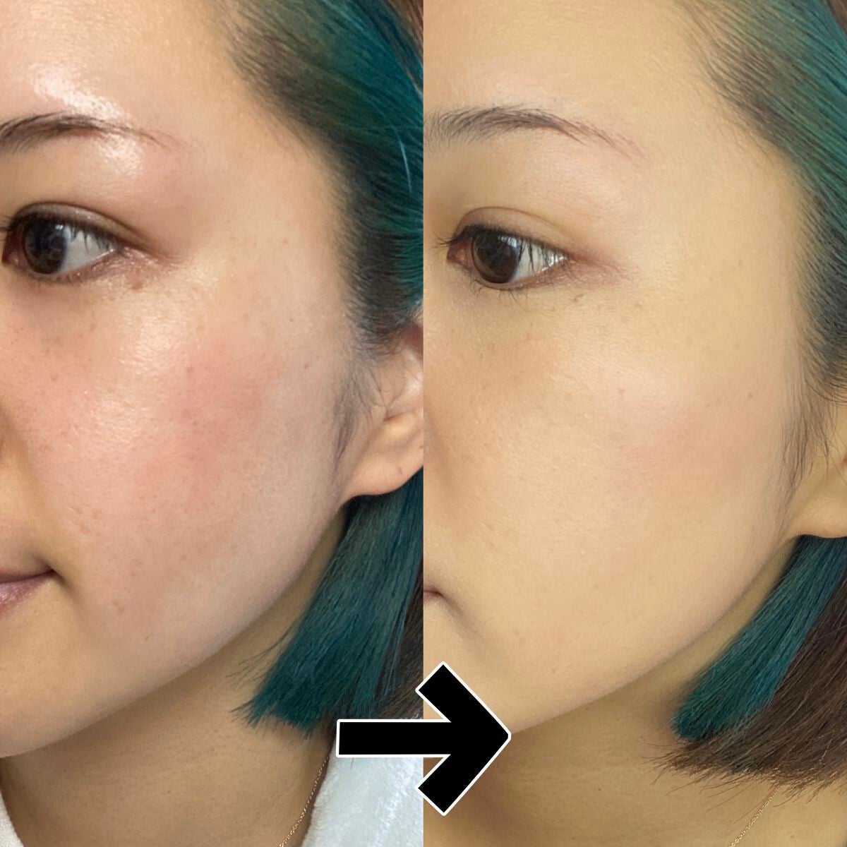 ビジョンファンデーション クッションクール/エクスボーテ/クッションファンデーションを使ったクチコミ(7枚目)