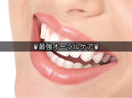 ステインクリア ペースト/オーラツー/歯磨き粉を使ったクチコミ(1枚目)