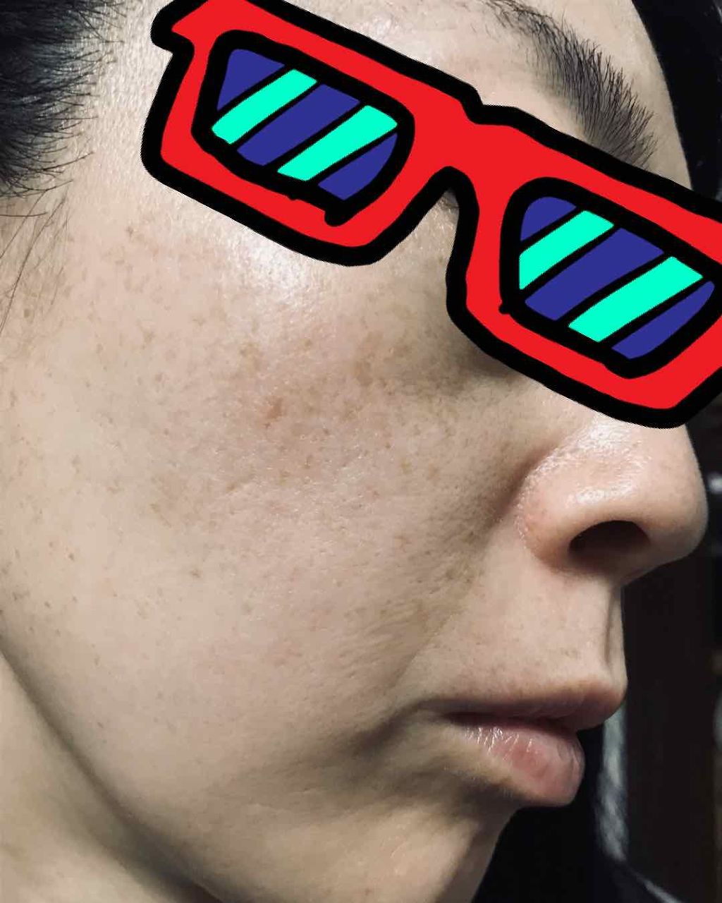 ひまこ on LIPS 「ひまし油経過です。写真の撮り方、なるべく同じにしたなのですが少..」(1枚目)