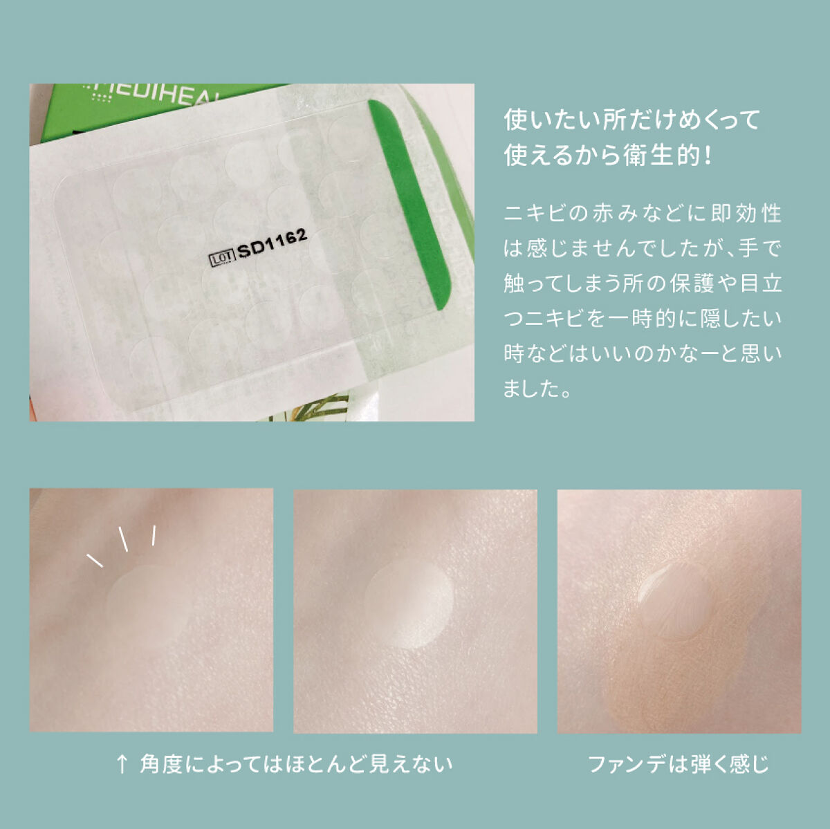 ティーツリーカーミングスポットパッチ/MEDIHEAL/その他スキンケアを使ったクチコミ（2枚目）