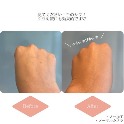 DEBEAUS バイオ インナー RX SRG クッション/DEBEAUS/クッションファンデーションを使ったクチコミ(4枚目)