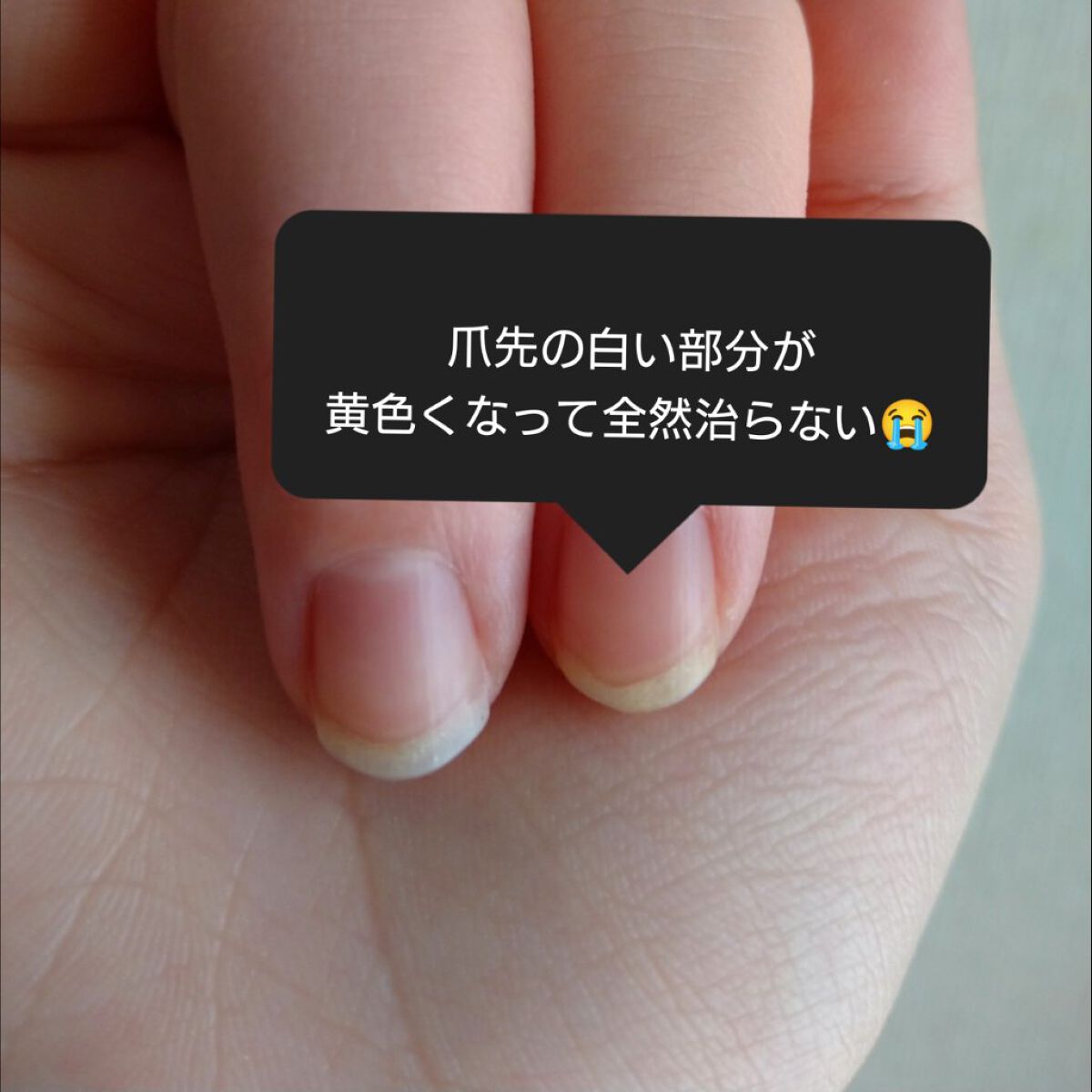 DS ライン コンセントレート 12.5 C/Kiehl's/美容液を使ったクチコミ（2枚目）