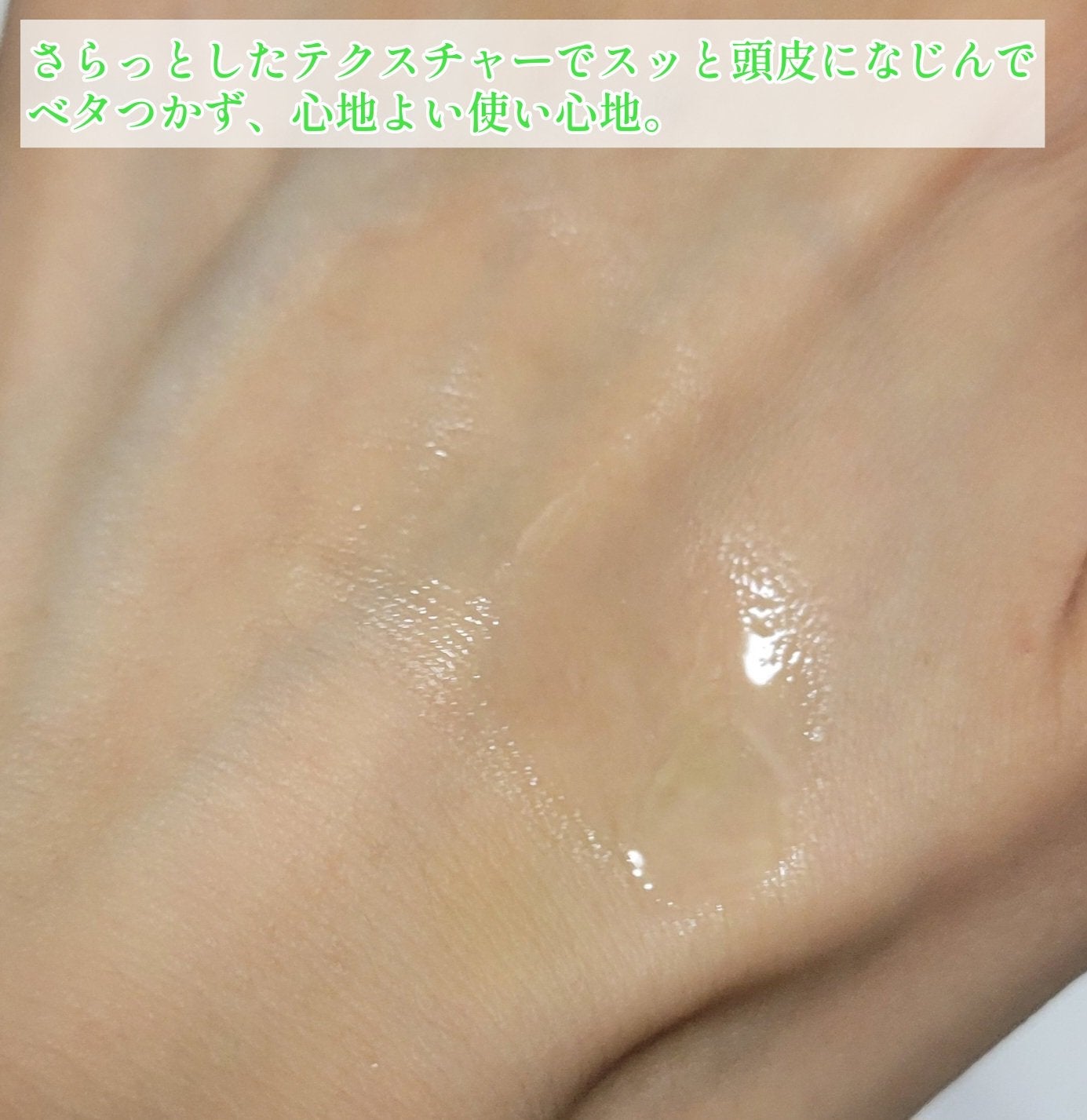 薬用 メディカル アンチヘアロスセラム/L'OCCITANE/頭皮ローションを使ったクチコミ(6枚目)