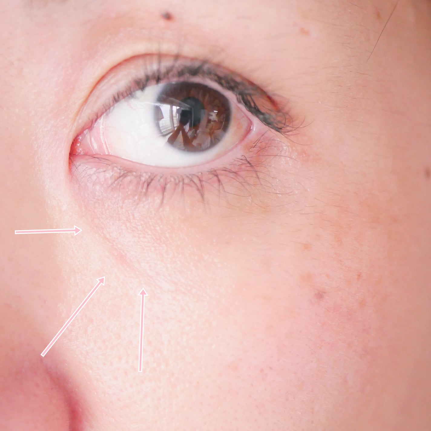 ポアタイトニングコラーゲンアンプル/Biodance/美容液を使ったクチコミ(9枚目)