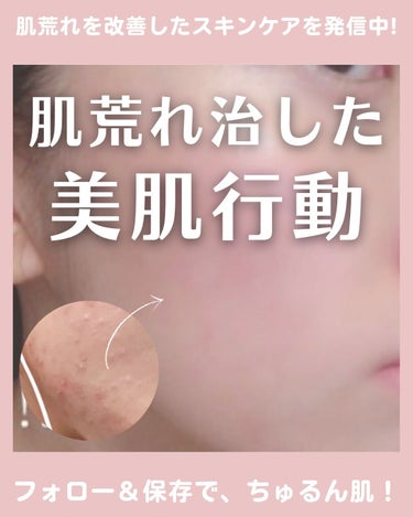 なーこ🫧ニキビ・肌荒れを美肌に on LIPS 「｜@naaacosme→肌荒れ地獄から、ファンデ断ちができるま..」（1枚目）