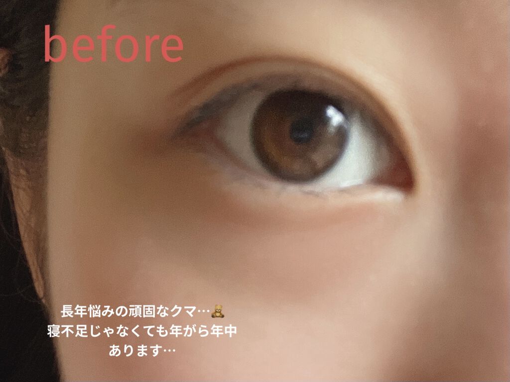 【旧】ディオールスキン フォーエヴァー スキン コレクト コンシーラー/Dior/リキッドコンシーラーを使ったクチコミ（3枚目）