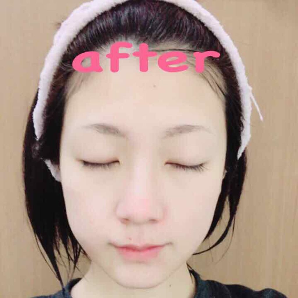 モッチスキン 吸着泡洗顔/MoccHi SKIN/泡洗顔を使ったクチコミ(2枚目)