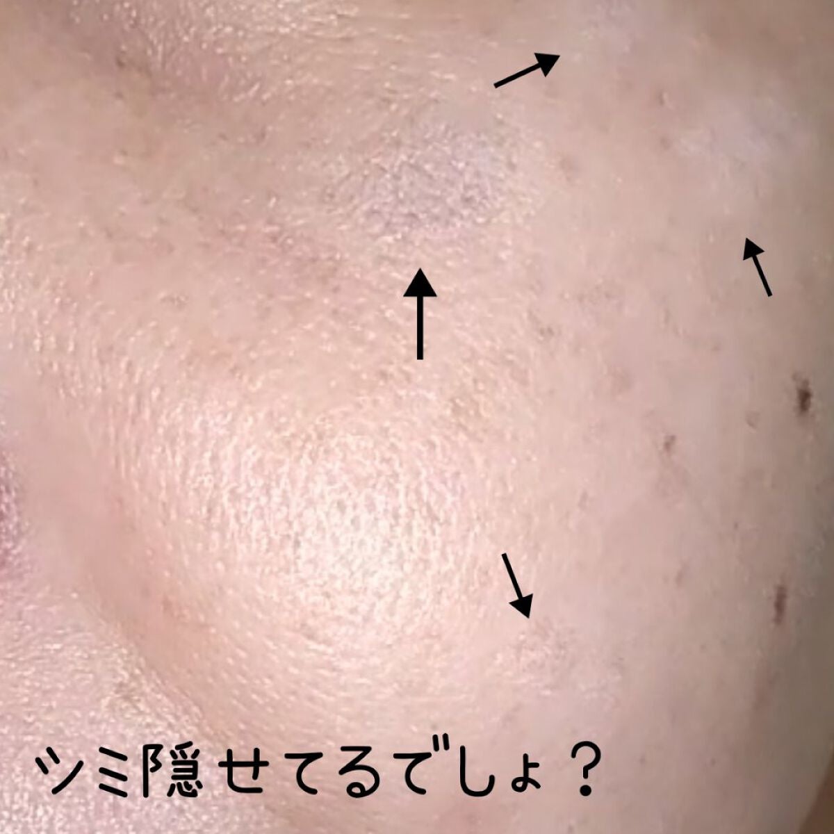 ソフトマットコンプリートコンシーラー/NARS/クリームコンシーラーを使ったクチコミ(3枚目)
