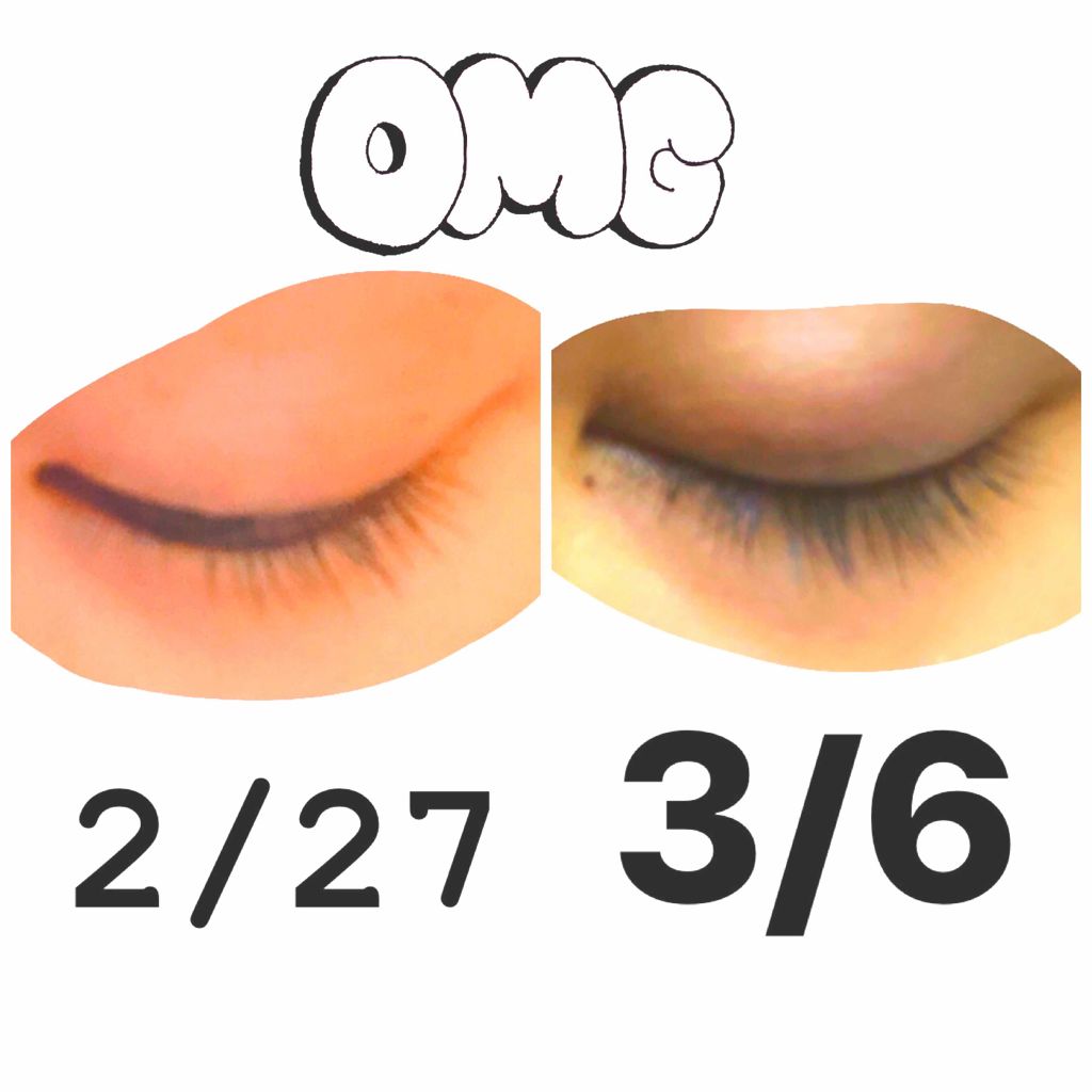 ローヤルゼリー配合 栄養ローション/DAISO/美容液を使ったクチコミ（1枚目）