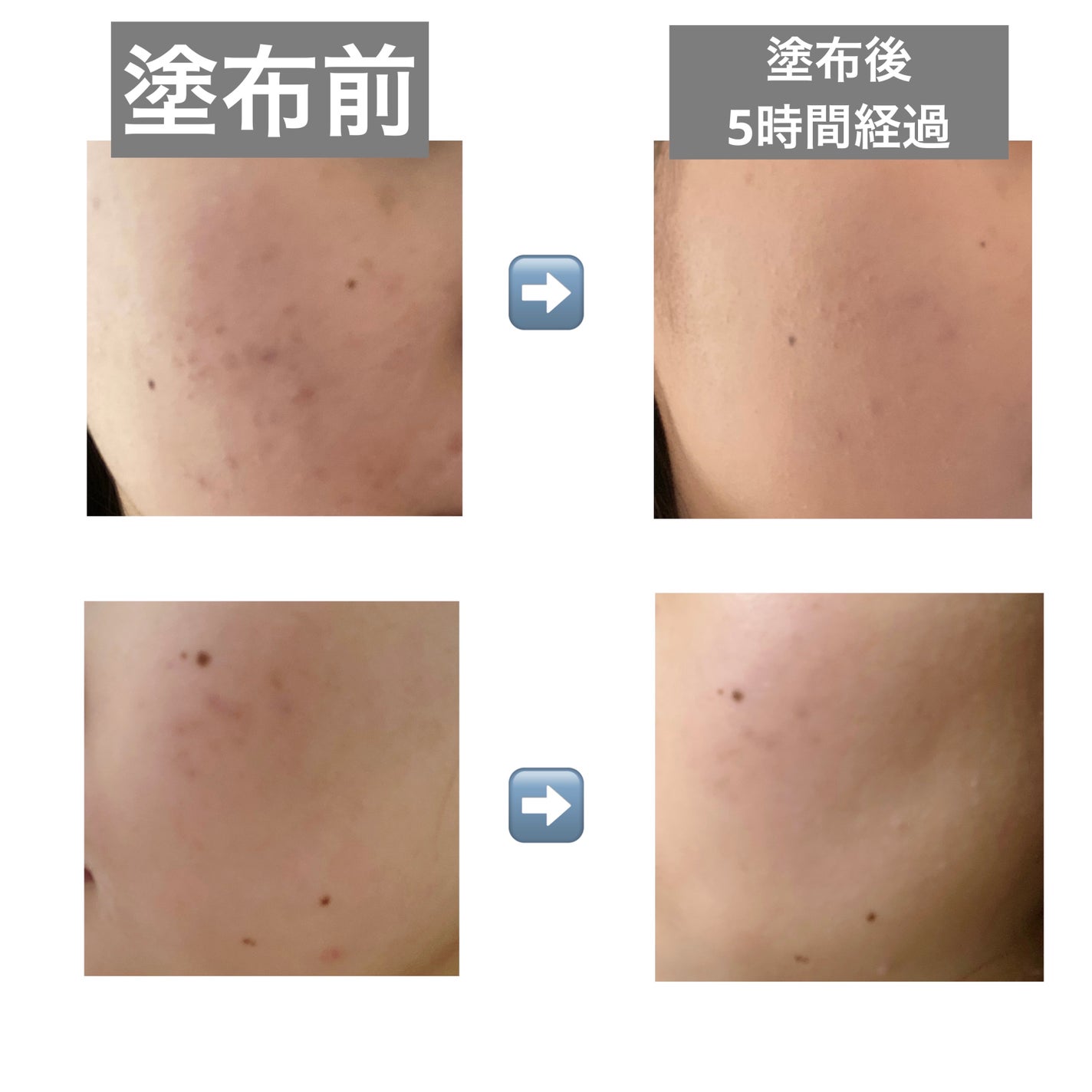 フィットグロウクッション/キャンメイク/クッションファンデーションを使ったクチコミ(2枚目)