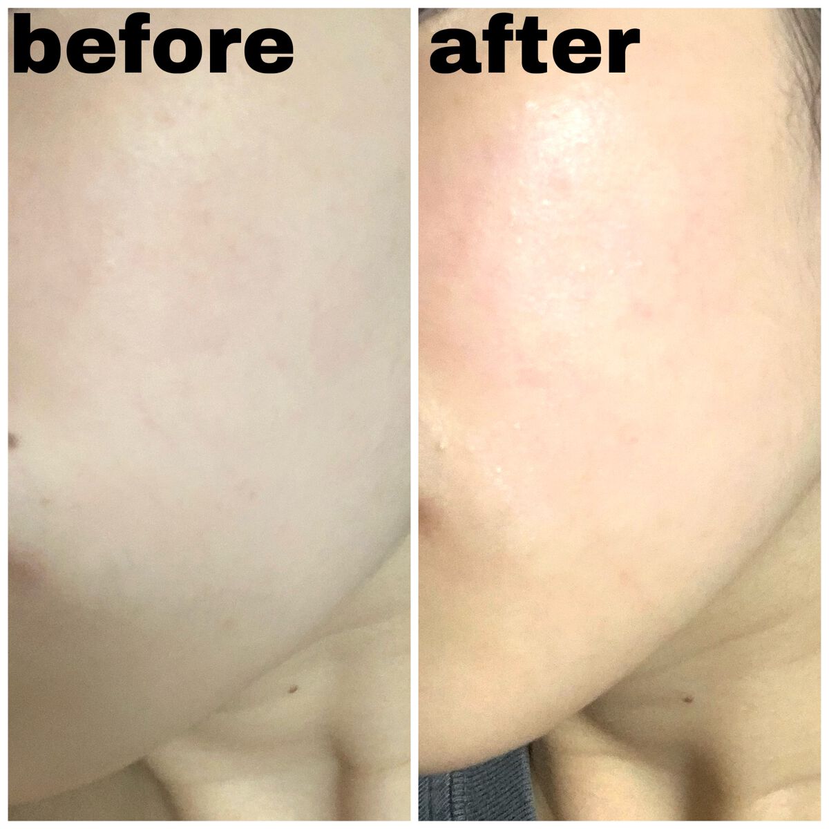 ルルルンピュア エブリーズ/ルルルン/シートマスク・パックを使ったクチコミ（2枚目）