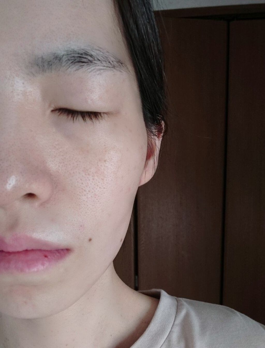 ドクダミ 77 スージングトナー/Anua/化粧水を使ったクチコミ(10枚目)