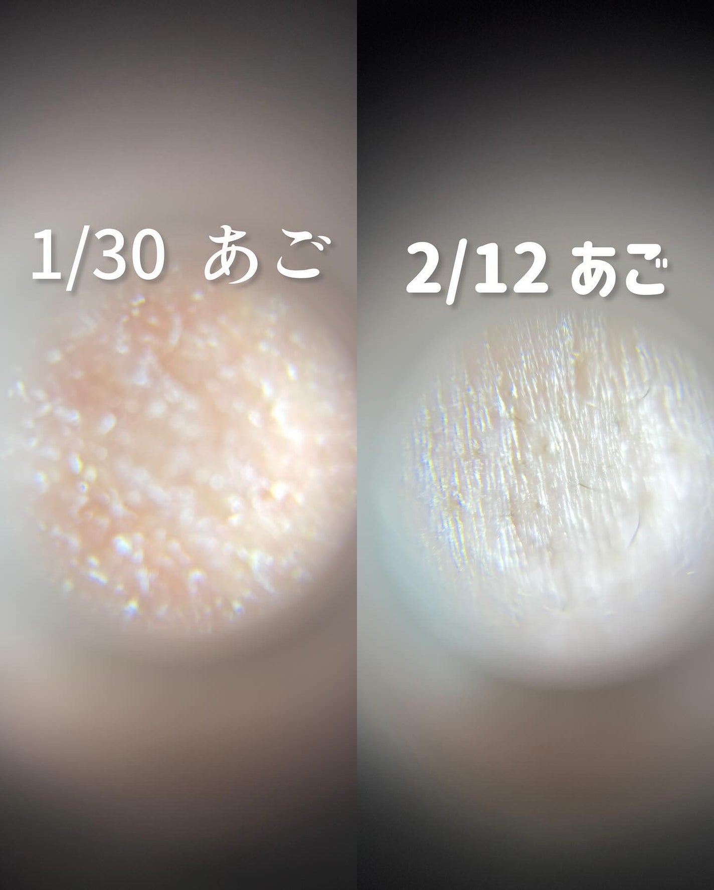 リードルショット100/VT/美容液を使ったクチコミ(7枚目)