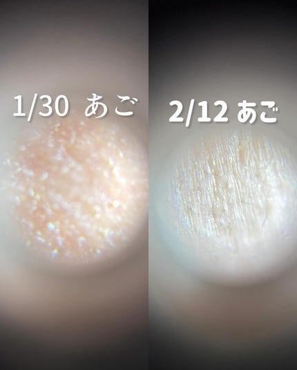 リードルショット100/VT/美容液を使ったクチコミ(7枚目)