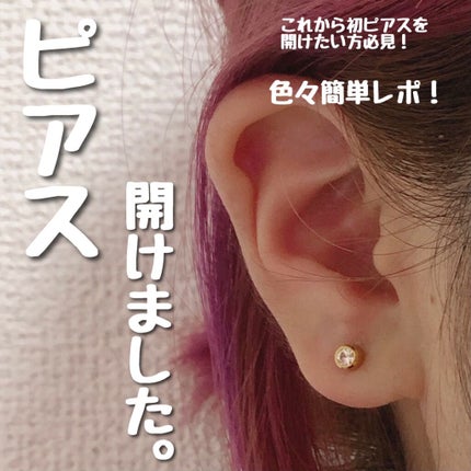 マキロンs (医薬品)/マキロン/その他を使ったクチコミ(1枚目)