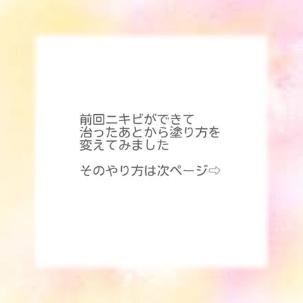 ハイポアレジェニック シカ クリーム/Dermatory/フェイスクリームを使ったクチコミ(4枚目)