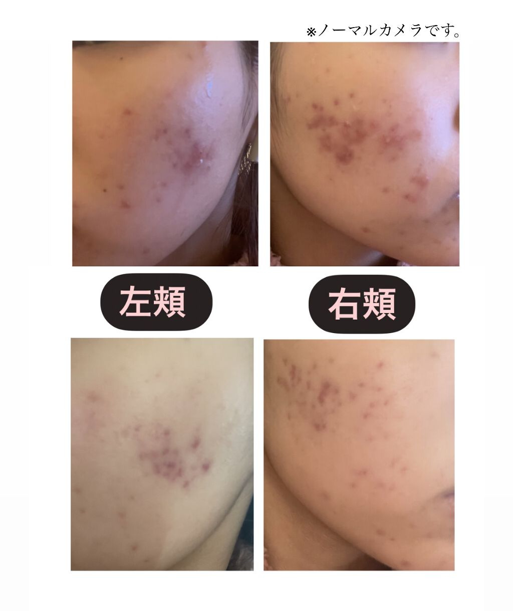 うるおいジェリー とてもしっとり/ビオレ/オールインワン化粧品を使ったクチコミ（2枚目）