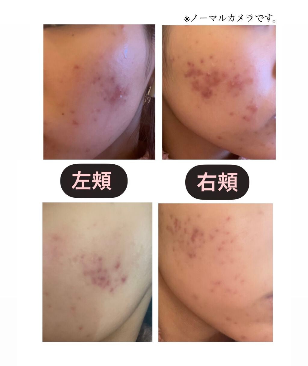 うるおいジェリー とてもしっとり/ビオレ/オールインワン化粧品を使ったクチコミ(2枚目)