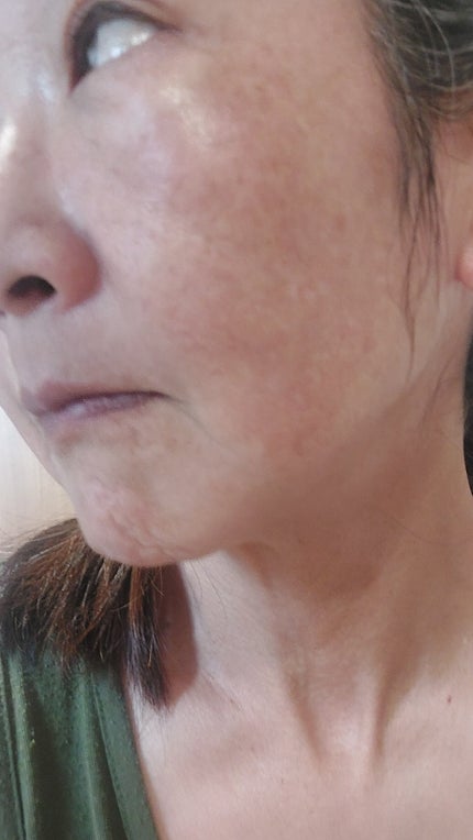 ピンクアロエメレンゲクレンザー/APRILSKIN/その他洗顔料を使ったクチコミ(8枚目)