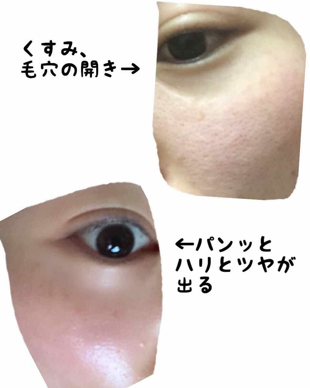 PEPTIDE VOLUME BUBBLE MASK/DR.PEPTI/シートマスク・パックを使ったクチコミ(2枚目)