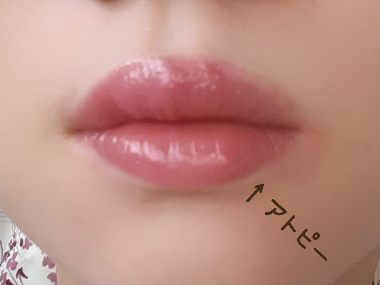 アンドバイロムアンド　グラッシーボムティント/&nd by rom&nd/リップティントを使ったクチコミ（2枚目）