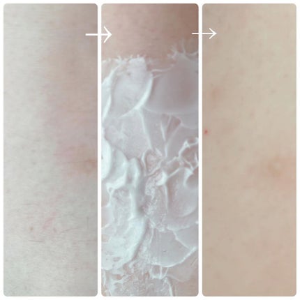 エピリムーバー N/TBC/除毛クリームを使ったクチコミ(6枚目)