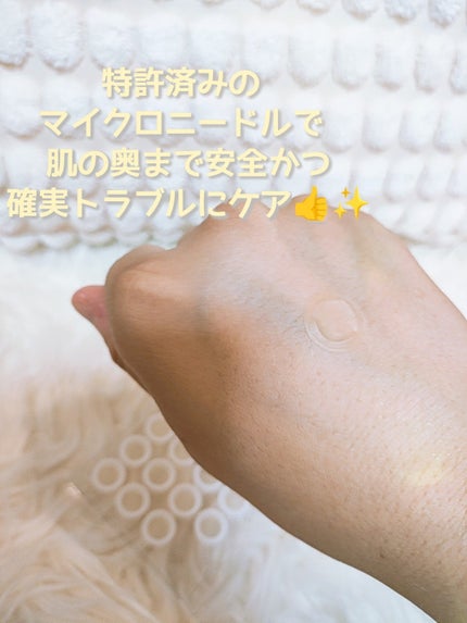 エーキュアショットスポットパッチ/obsero/にきびパッチを使ったクチコミ(2枚目)